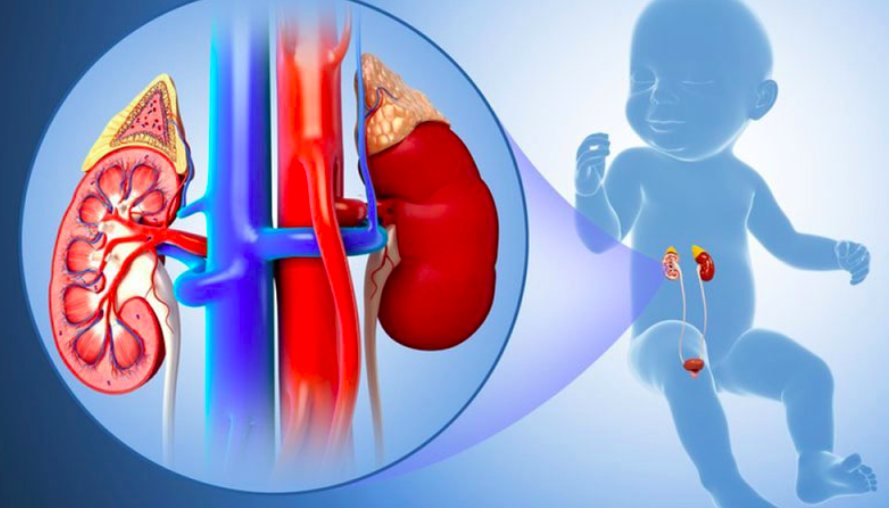 thận nhi, bệnh thận nhi, nhiễm trùng tiểu ở trẻ, viêm cầu thận trẻ em, lupus thận, ghép thận trẻ em